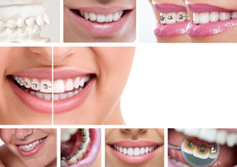 Orthodontist – Alignment Specialist